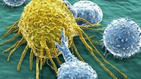 ung-thu-shutterstock_xqvv